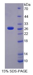 SDS-PAGE (TNFSF14-7782H).jpg